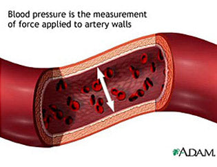 High Blood Pressure & Hypertension - Is there a cure?